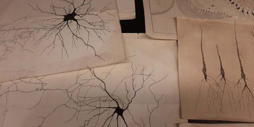 Cellule nervose Golgi